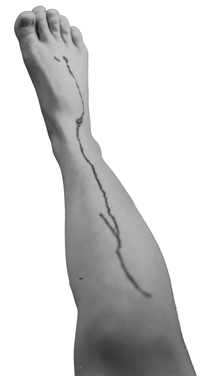 Right Foot